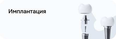 Имплантация