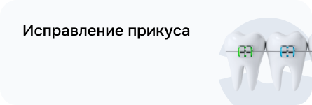 Исправление прикуса